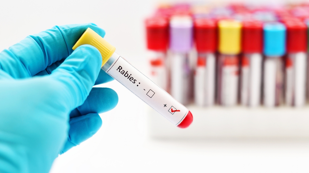 Rabies alert issued for Clay County after raccoon tests positive
